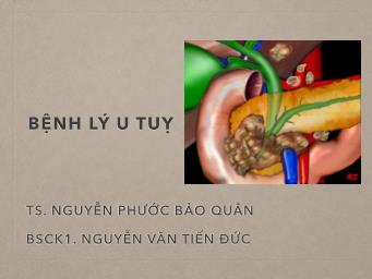 Bài giảng Bệnh lý u tụy - Nguyễn Phước Bảo Quân