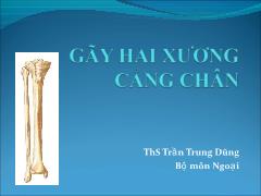 Bài giảng Gãy hai xương cẳng chân - Trần Trung Dũng