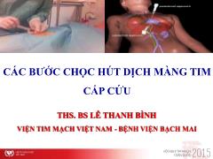 Bài giảng Các bước chọc hút dịch màng tim cấp cứu – Lê Thanh Bình